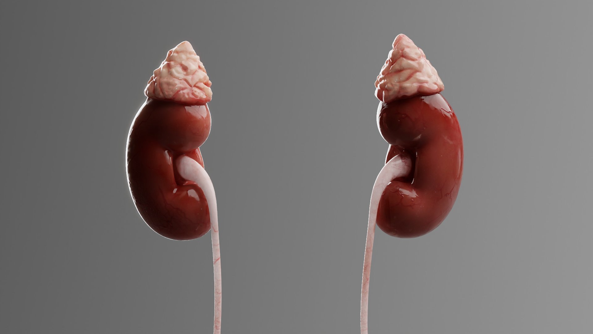 Sickle Cell: CGI kidneys