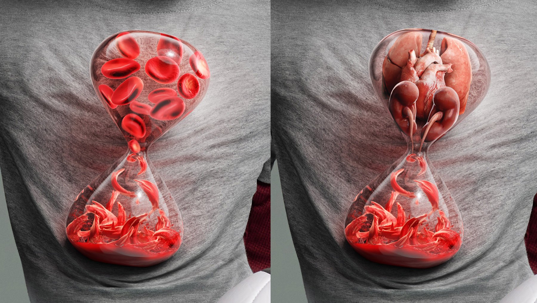 Sickle Cell, image 6